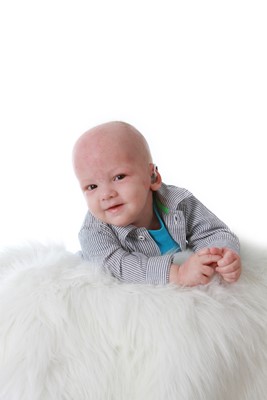 St. Jude patient Noah, 11 months, brain tumor