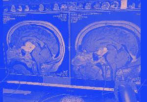 Personal fundraising photo